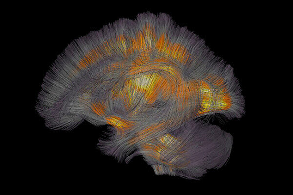 Visualization of the human brain's neural pathways with colorful fiber tracts, highlighting connections in orange and yellow on a black background.